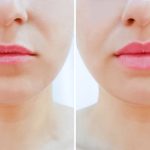 girl lips before and after magnification